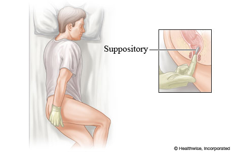 How to use a suppository.