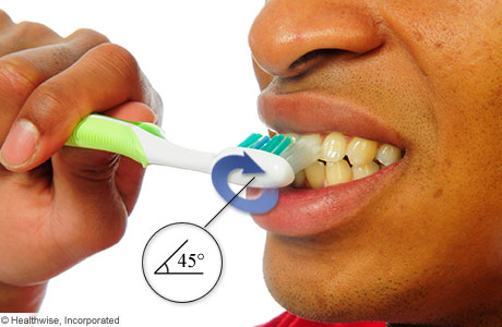 Holding a toothbrush at a 45-degree angle.
