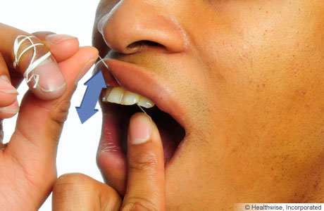 Person flossing, showing floss moving up and down between teeth.