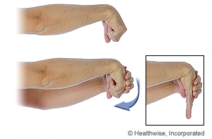 Picture of the wrist extensor stretch