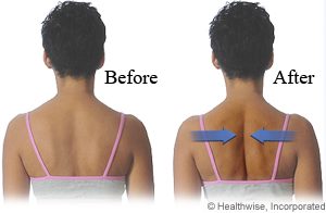 Picture of how to do shoulder blade squeeze