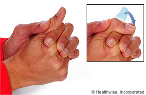 Picture of the thumb IP flexion exercise