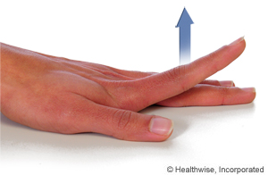 Picture of how to do finger extension exercise