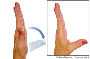 Picture of thumb abduction/adduction exercise