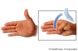 Picture of thumb flexion/extension exercise