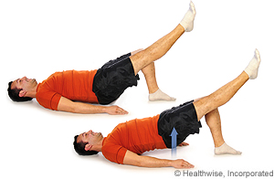 Picture of how to do single-leg bridge exercise