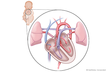 Fetal heart circulation