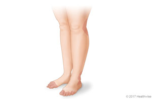Places on the legs and feet where rashes are common.