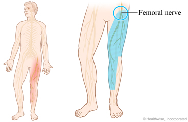 Picture showing location of femoral nerve
