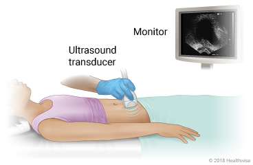 Ultrasound of abdomen, showing ultrasound transducer placed on belly and test image displayed on monitor