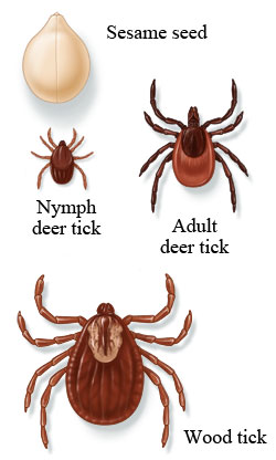 Three types of ticks, compared to the size of a sesame seed