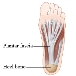 Picture of the bottom of the foot and the plantar fascia