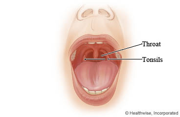Throat and tonsils