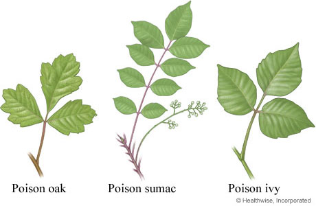 Poison ivy, oak, and sumac leaves