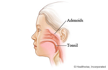 Location of adenoids and tonsils