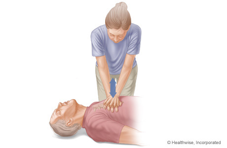 Arm and body positions for doing chest compressions