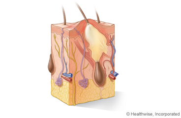 Picture of layers and structures of the skin