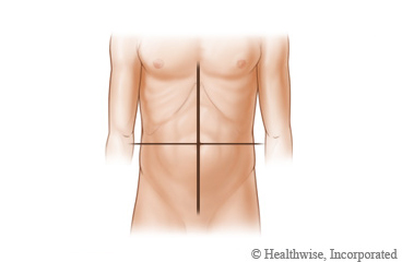 Picture of the four quadrants of the abdomen.