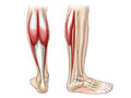 Endurocad - Injury Focus- Calf Strain A calf strain is an injury to the  muscles in the calf area (the back of the lower leg below the knee). The  calf muscle is