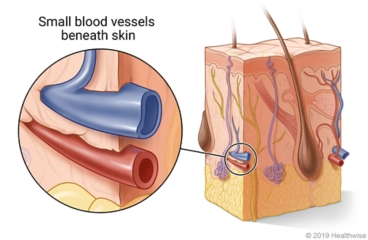 Cross section of the skin, with detail of small blood vessels under surface of skin
