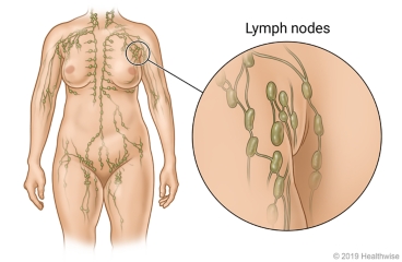 Location of lymph nodes throughout the body, with detail of lymph nodes near the armpit