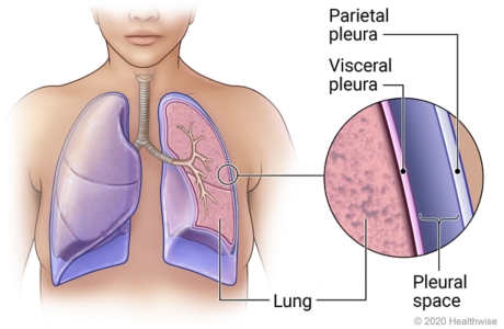 Pleura of the lungs