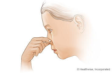 Pinching the nose with thumb and forefinger to stop a nosebleed