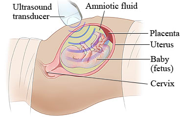 Ultrasound of a pregnant woman's belly