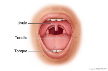 Open mouth showing throat, uvula, tonsils, and tongue.