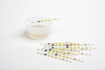 Urine sample in container and test strips.