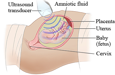 Fetal ultrasound