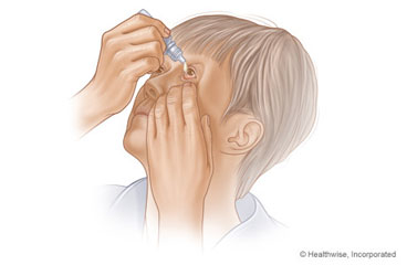 Putting in eyedrops.