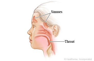 Sinuses and throat in a child