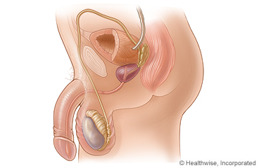 The male reproductive system