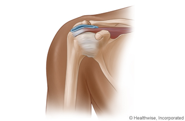 The bones and some of the tissues in the shoulder