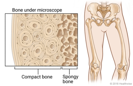 cross-section view of bone under microscope, showing outer compact bone and inner spongy bone.