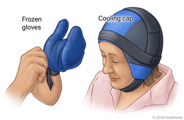 Cold caps for chemotherapy treatment online