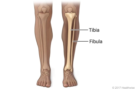 Skeletal view of bones of lower leg, the tibia, and fibula (shin bone)