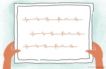 A picture of Elsie's heartbeat