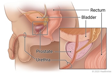 Location of prostate between bladder and urethra in front of rectum, with detail of urethra passing through prostate.