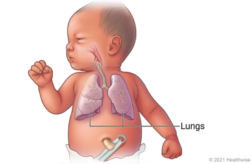 Respiratory system of newborn, including lungs and airways to lungs.