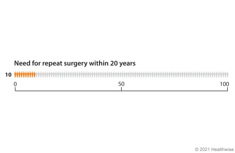 Graph with 100 figures, showing 10 figures coloured to represent how many need repeat knee replacement surgery within 20 years.