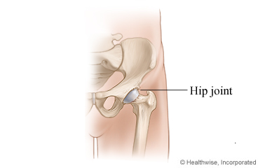 Hip joint