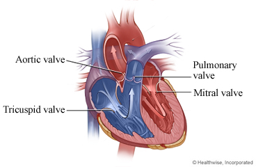 Heart valves