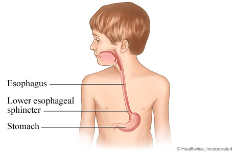 Picture of esophagus in child.