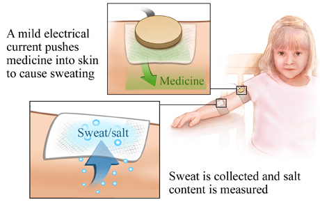 Picture of the sweat test procedure.
