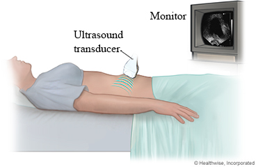 Pelvic ultrasound