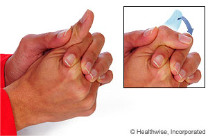 Thumb Arthritis Exercises