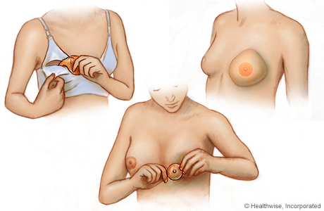 Types of breast forms