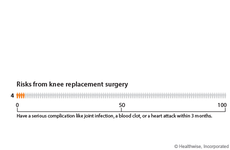 chart showing risks from knee replacement surgery